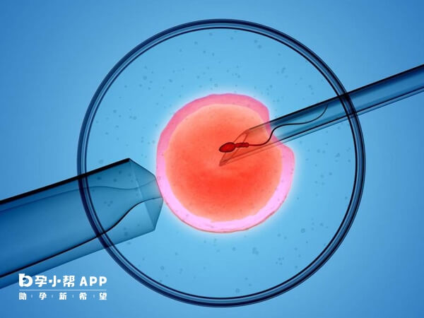 微刺激方案具有治疗周期短作用