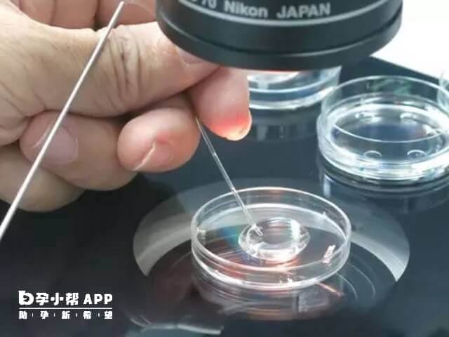 神经母细胞瘤一种癌性肿瘤