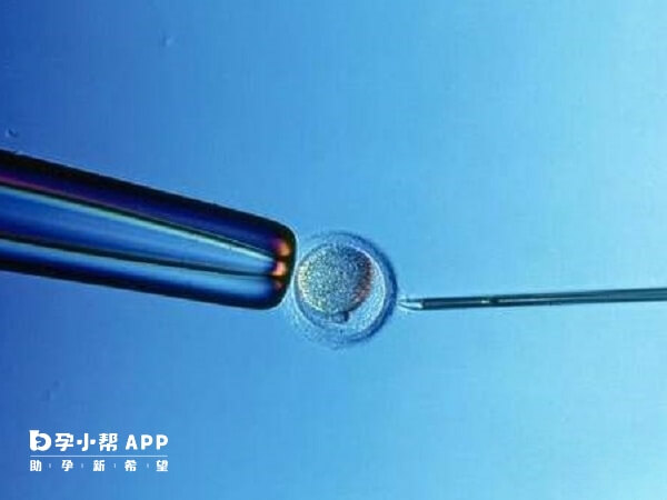 北京大学第一医院的成功率在50%-55%左右