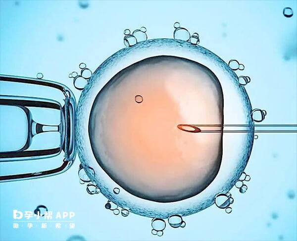 阴缩即阴道不自主收缩