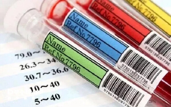 男性也可以检查性激素