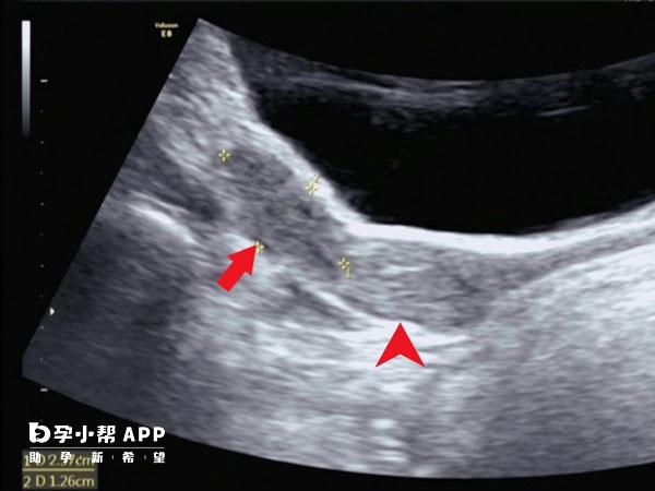 良好的生活习惯有助于身体健康