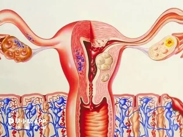 子宫内膜容受性评估简称容受检查