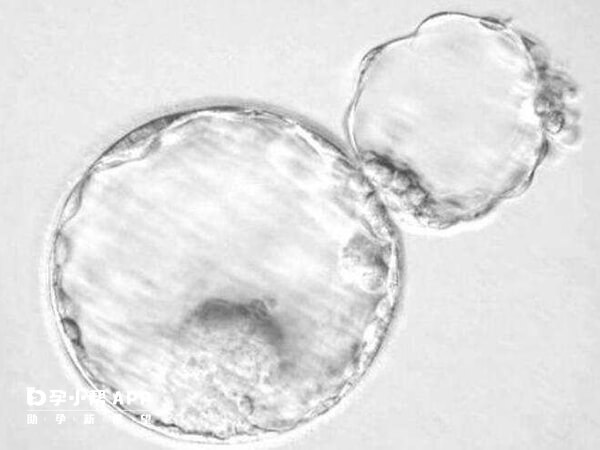 采用辅助生殖技术1胎/次补助2万元