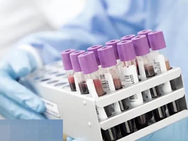 术前检查是人工授精的流程之一