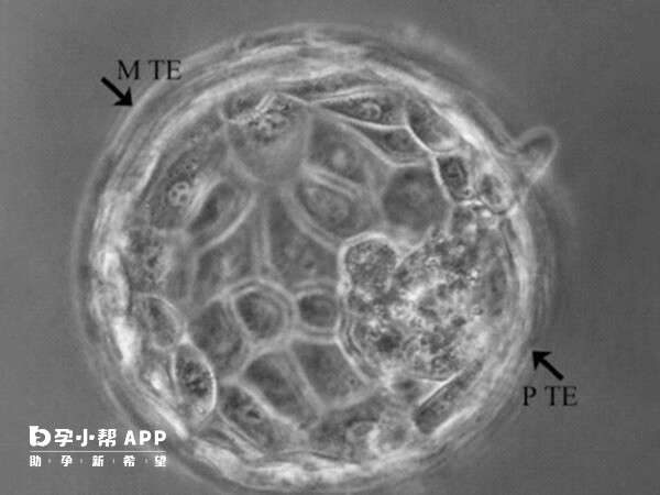 优先选择形态学评分高的囊胚移植