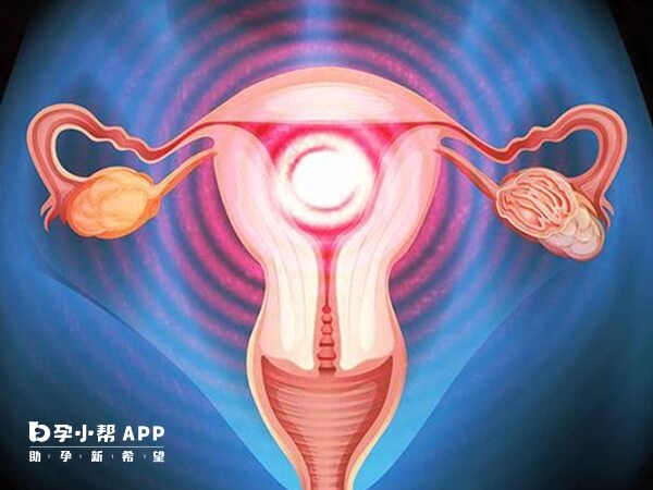 女性切除子宫病情会明显好转