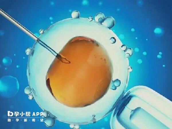 北京和上海在试管婴儿技术方面都处于国内领先地位