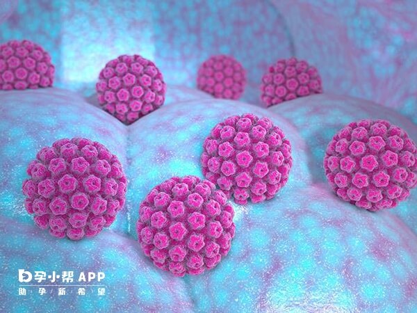 HPV是人乳头瘤病毒的缩写