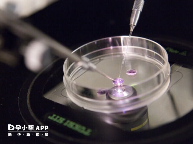 AZFc缺失做试管婴儿成功率大概有30%左右