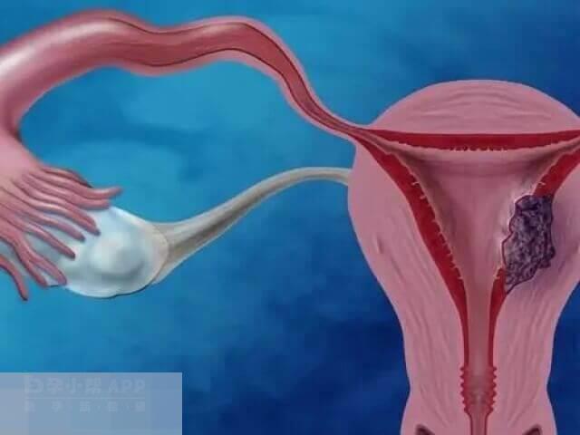 胚胎迷路跑到子宫外边安家的过程