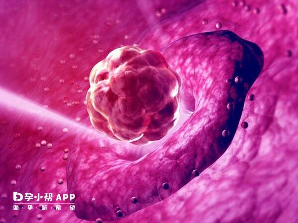 宫外孕会造成移植17天出血