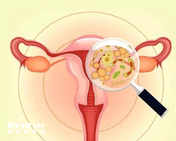 长方案中的降调节药物可抑制异位病灶生长