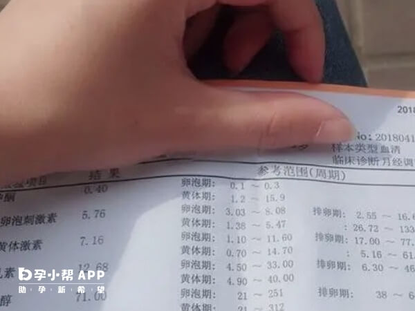 激素六项是检查女性内分泌系统的一项指标