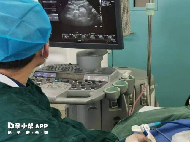 试管移植后胎停育的表现时间因人而异