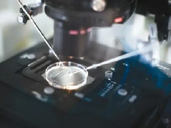 冻胚移植周期最常使用的是自然周期