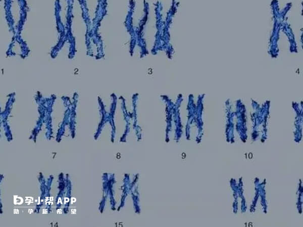 同卵双胞胎的性别由受精时精子的性染色体决定