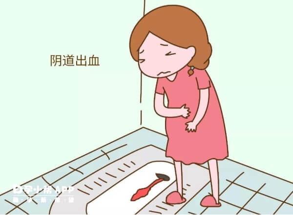 孕酮低也会导致流血