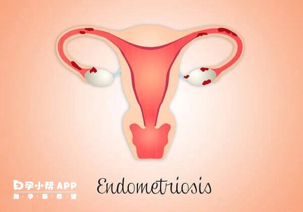 达菲林和达必佳治疗作用相似