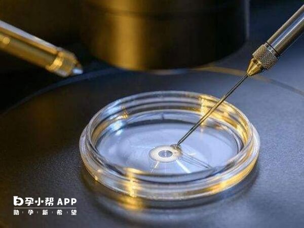 试管婴儿解冻生第二胎流程并不是特别复杂