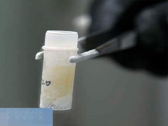 取精是在取精室通过手淫取精