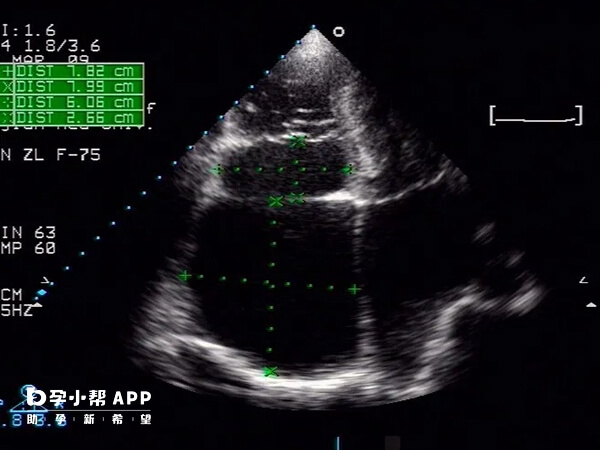 胚胎移植之后会自行游走