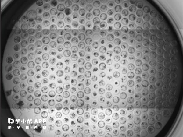 胚胎透明带厚可能由多种原因导致