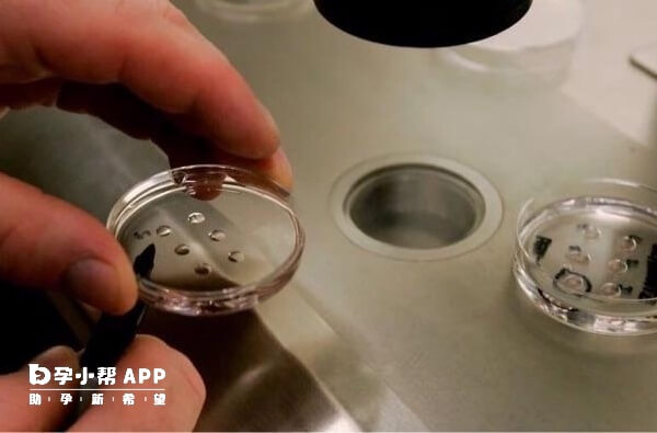 试管技术是许多不孕夫妇选择的治疗方式之一