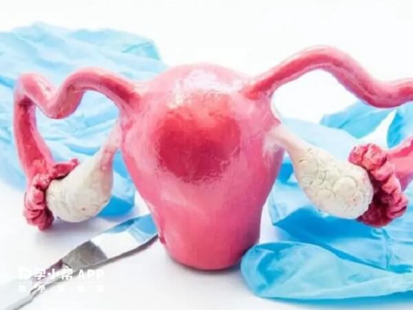 幼稚子宫手术治疗疗效好恢复快