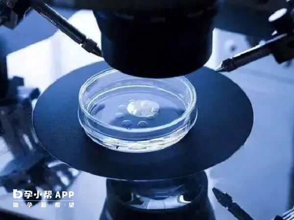 双胞胎的智力水平与普通人群无本质区别