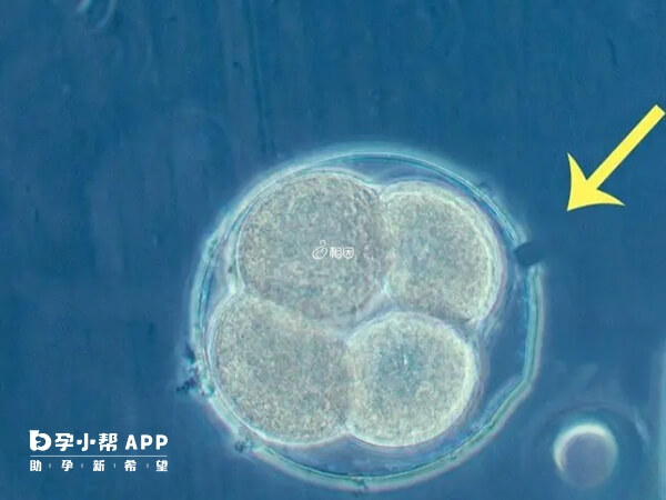 人体胚胎孵化项目通常指胚胎辅助孵化技术