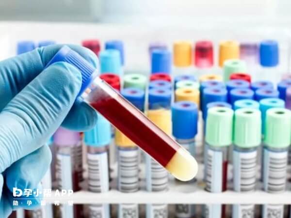 抽血检查性激素六项