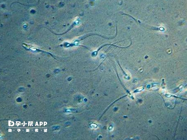 轻度少精症选择人工授精比较好