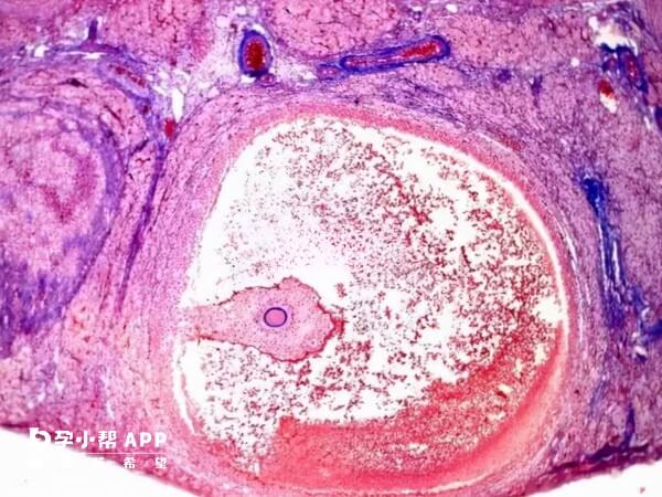 空卵泡有可能是周期性的