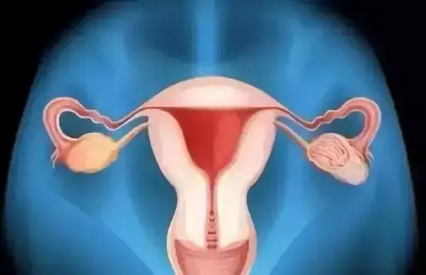 子宫切除手术方式有三种