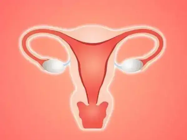 由炎症感染而造成宫腔粘连