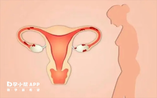 卵巢早衰的部分女性会有体重减轻的情况