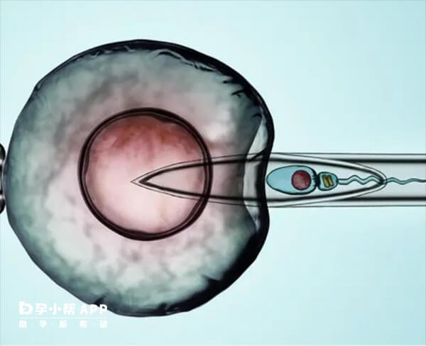 试管移植过程中通常需要适度扩张宫颈