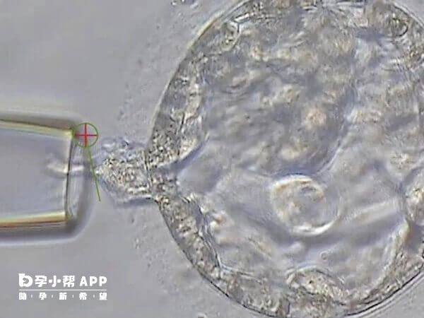 试管婴儿的排卵周期是让许多卵泡一同发育