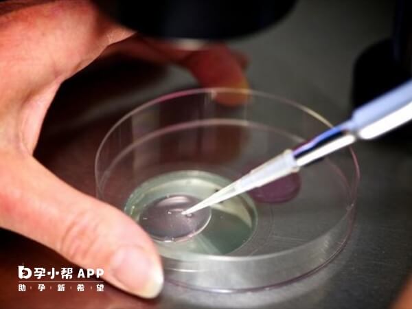 穴位埋线能够促进子宫内膜血液循环