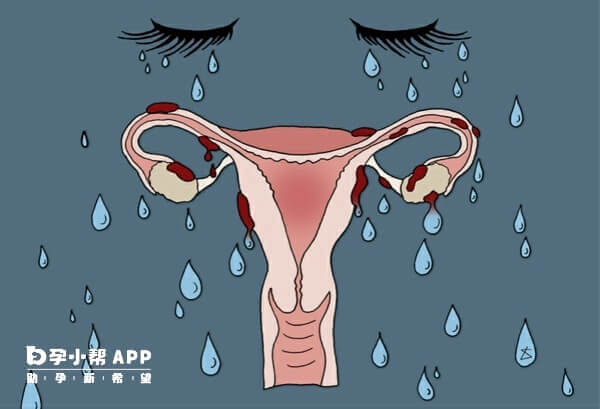 子宫切除有好处也有坏处
