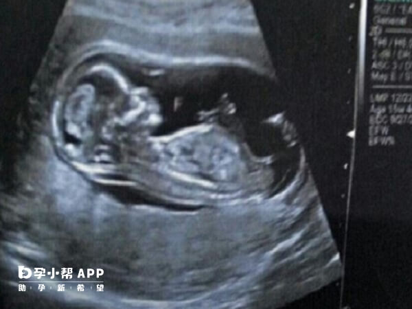 试管婴儿技术仅针对生育功能