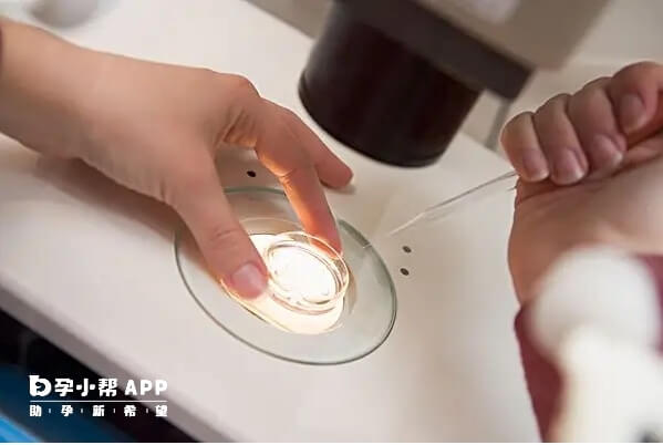 导致胎停育的原因是比较多的