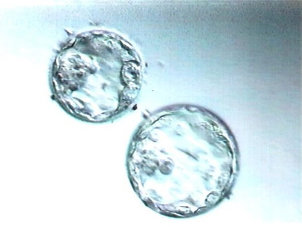 解冻胚胎生第二胎男方去医院很重要