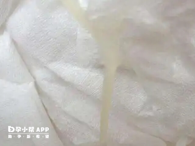 排卵期白带量会明显增多