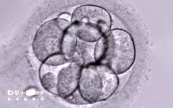 三代试管主要针对单基因病和染色体异常
