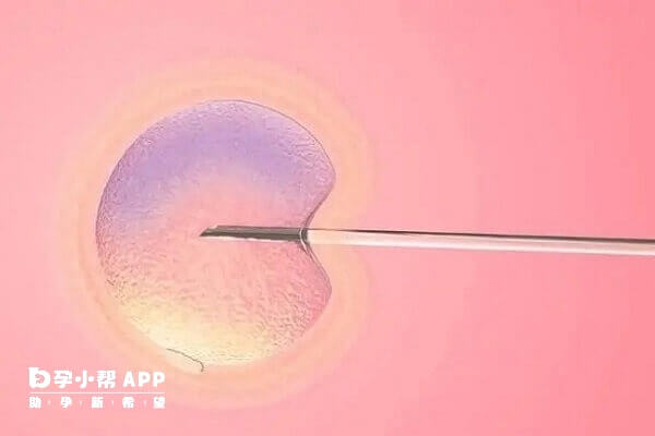 双胞胎大排畸是一项重要的孕期检查