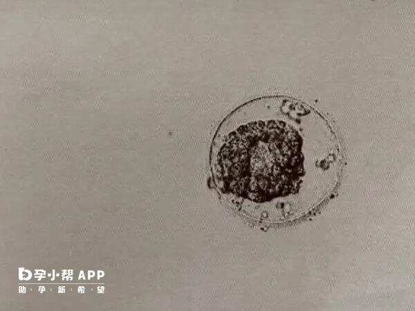 3BC囊胚的成功率并不一定高于4BC囊胚