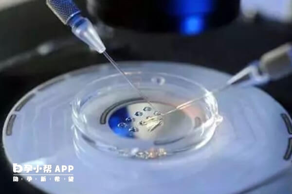 促排卵阶大概需要3-5次往返医院