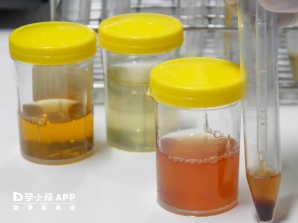 较大的心理压力会引起尿频